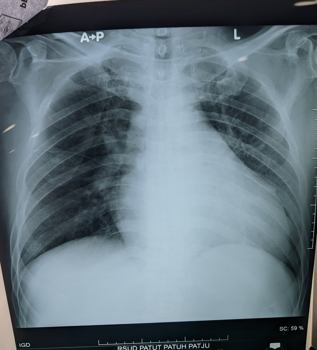 ROYU_ID's tweet photo. jaga kesehatan jantung sejak muda, kalo jantung udh besar gabisa dikecilin lagi, makin besar jantung makin rentan sesak🫀🫀#AcuteCoronarySyndrome https://t.co/w69D6HEBMn