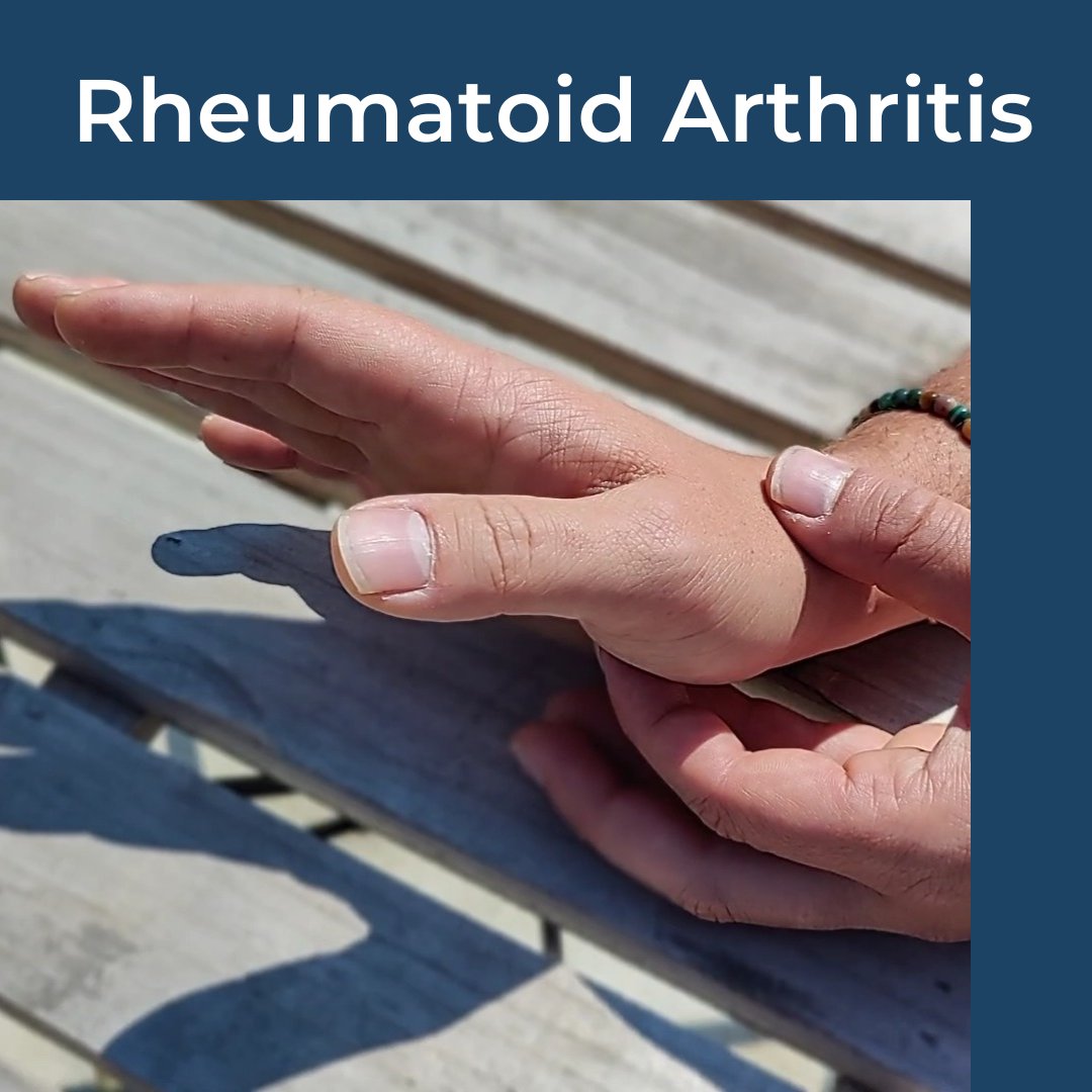 Its #RheumatoidArthritis awareness week.

Here is a list of resources from me on the topic. 

Thread 🧵 1/