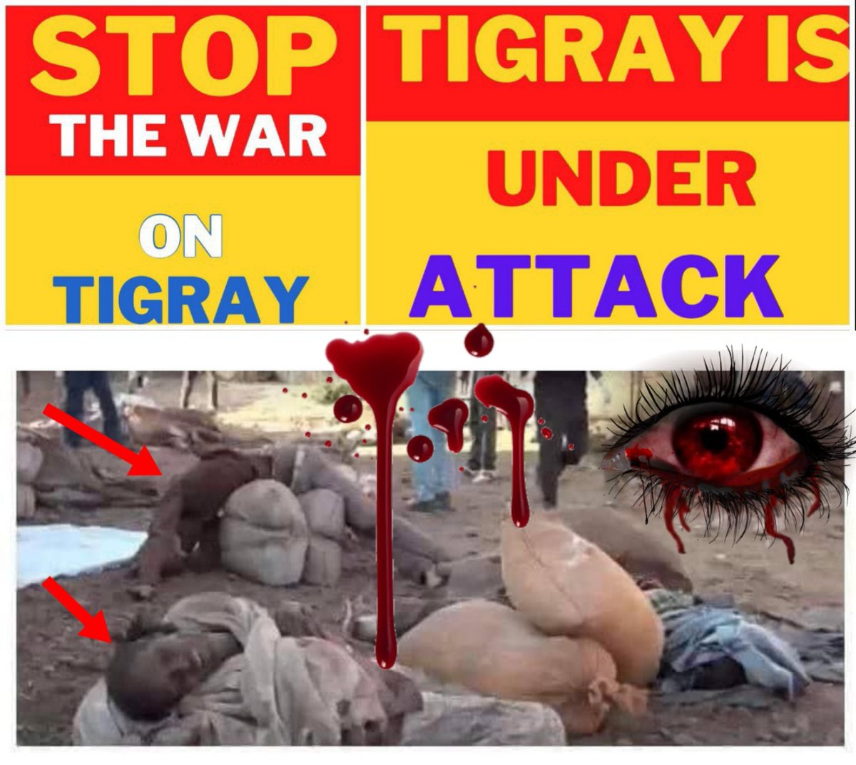 #EndTigraySeige Civilians in Tigray are still suffering! #NoFlyZoneInTigray
@AsstSecStateAF #StopWarOnTigray #StopBombingTigray #TigrayGenocide #TigrayUnderAttack 
@EUCouncil
@UN_HRC
@_AfricanUnion
@StateDept
@UN
@IntlCrimCourt
@ArmeniaUN
@volker_turk @maza_tigray