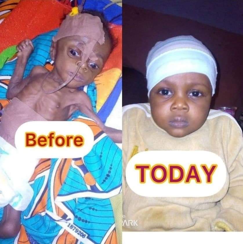 BEFORE &amp; AFTER. 
Some of my Humanitarian services from 2020 - 2022.