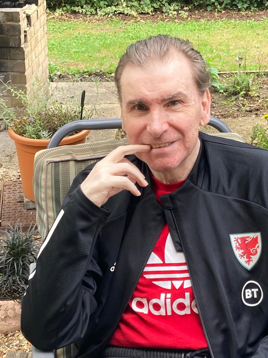 SimonShakey252's tweet image. An update from Tracey: This photo melts my heart. Shakey has been extremely poorly, we seriously nearly lost him a couple of months ago.His shoulder nearly fixed, sadly the more serious issues remain. Long road still ahead but we are slowly getting there #stroke #heartfailure #AF