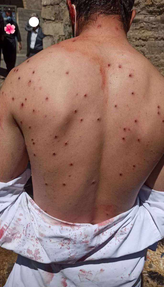 Fateme🍓 tweet media