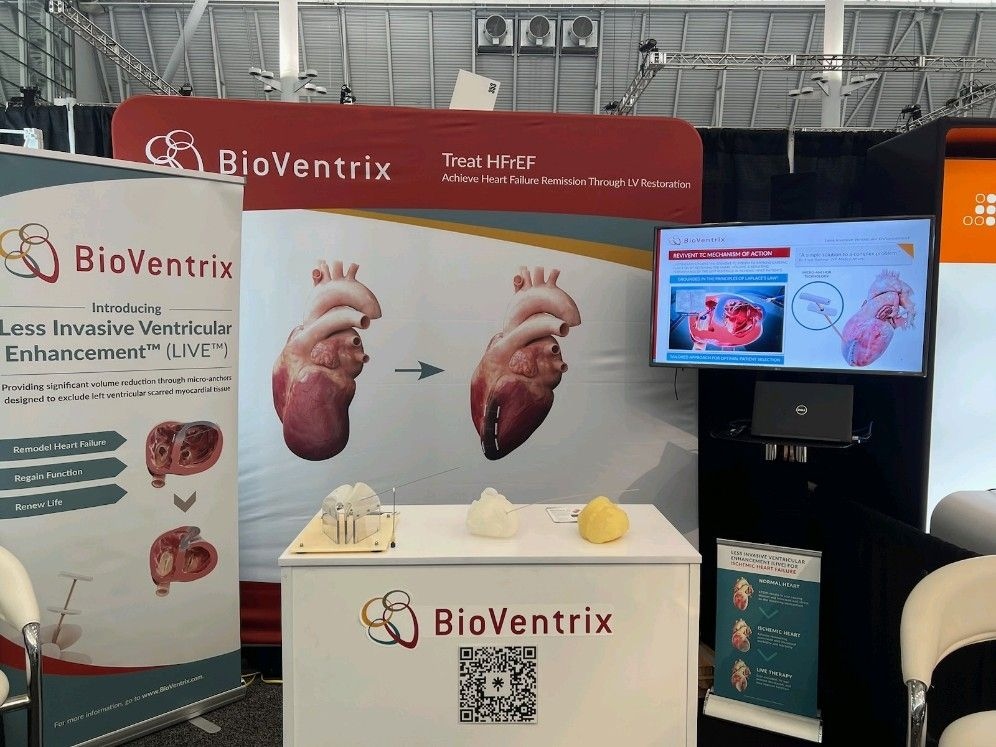 BioVentrix (@bioventrix) on Twitter photo Stop by our booth #353 learn more about treating HFrEF to achieve Heart Failure Remission through LV Restoration with BioVentrix. 
#HeartFailure #StructuralHeart #LVreshape #ReviventTC #LIVETherapy
<a href="/cardiovascular/">cardiovascular</a>-research-foundation Stop by our booth #353 learn more about treating HFrEF to achieve Heart Failure Remission through LV Restoration with BioVentrix. 
#HeartFailure #StructuralHeart #LVreshape #ReviventTC #LIVETherapy
<a href="/cardiovascular/">cardiovascular</a>-research-foundation