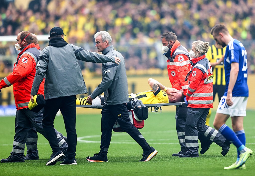 brfootball's tweet photo. Marco Reus looked distraught as he was stretchered off with an injury just a couple of months before the start of the World Cup https://t.co/xypuFuTIW4