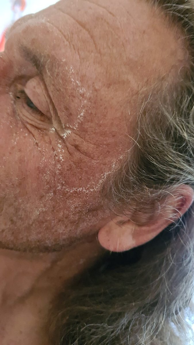 Zout op de kop, maar de Oslo marathon zit erop. <a href="/HupLopen/">Reisjefit</a> <a href="/Loopkoorts/">Loopkoorts</a> <a href="/loopmaatjes/">Loopmaatjes</a>