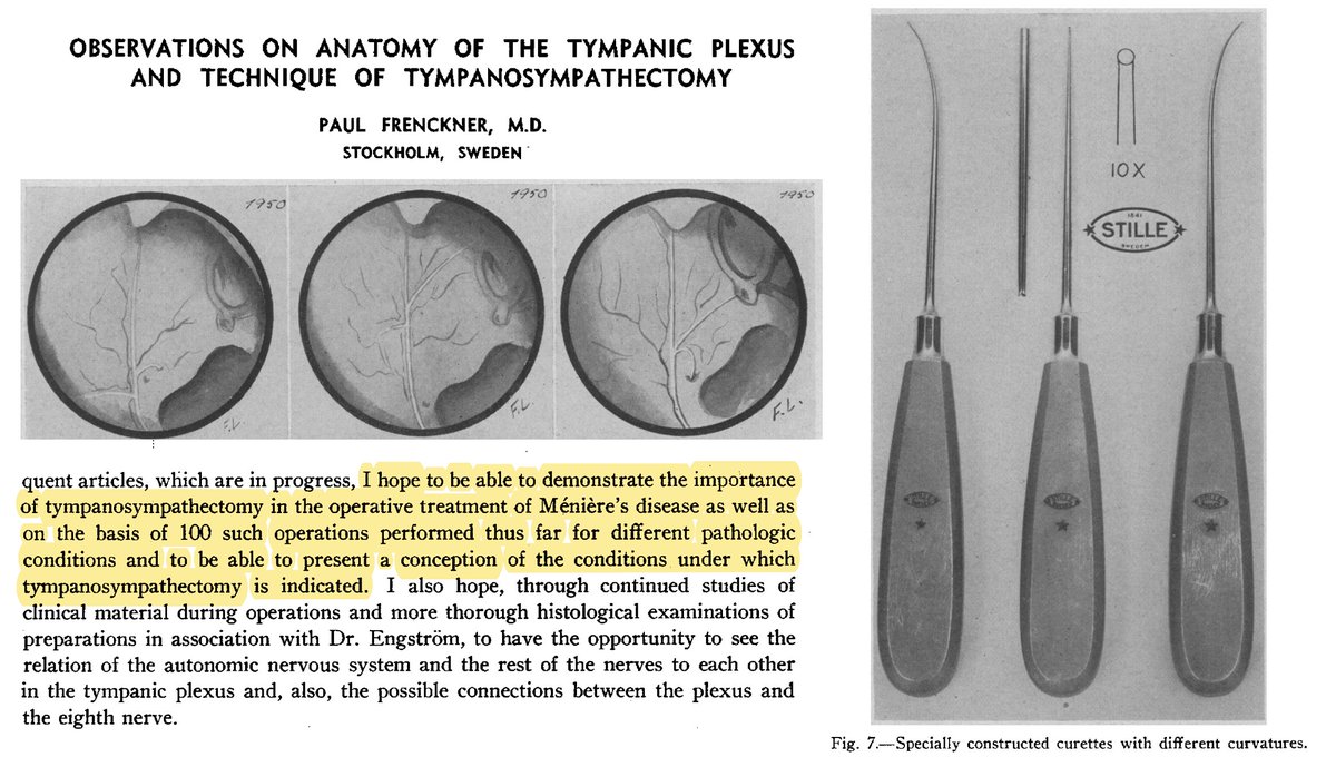 WardensMD's tweet photo. Thomas Lempert (1946) thought the tympanic plexus on the cochlear promontory was functionally important.  Others like Swedish ENT Frenckner removed it for disease, of course, including #Meniere's disease.  Bonus for the specially designed instruments. #HistoryInMénièresDisease https://t.co/QkUOXo0Ec9