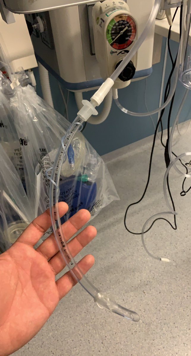 DrCasteelEM's tweet photo. Pro-tip for bloody airways. Rigid Yankauers suck at getting into the posterior oropharynx (especially if using a hyperangulated blade). Connect suction tubing to an ETT then tape a stylet to it, and you now have a malleable large bore suction catheter. #FOAMed #EmergencyMed https://t.co/qe5AlGfB9F