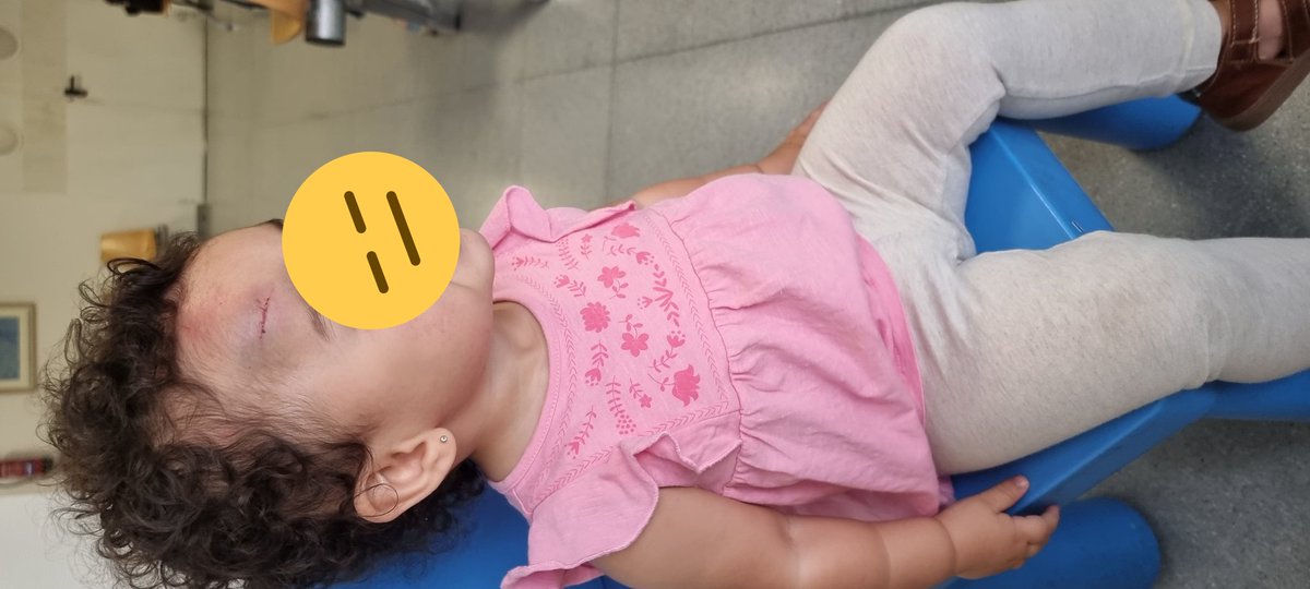 RSerraoJr's tweet photo. @el_renegon1975 Mi bebé de año y medio se cayó en el parking y justo había una alcantarilla que sobresalía, en el Centro de Salud le dieron hielo; me fui al hospital y le recetaron paracetamol. Sin placas y sin evaluación computarizada. Yo no me explico porque obligan a pagar Seguridad Social🤷‍♂️ https://t.co/7K8tJkmxMn