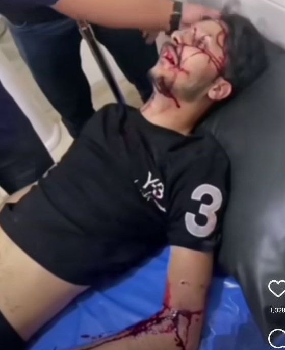 MS_SherafatPour's tweet photo. The Iranian government is killing young Iranians🖤
Help us😶
#کیان_درخشان 
#مهسا_امینی 
#پارسا_صحت https://t.co/CePPIFlRSP
