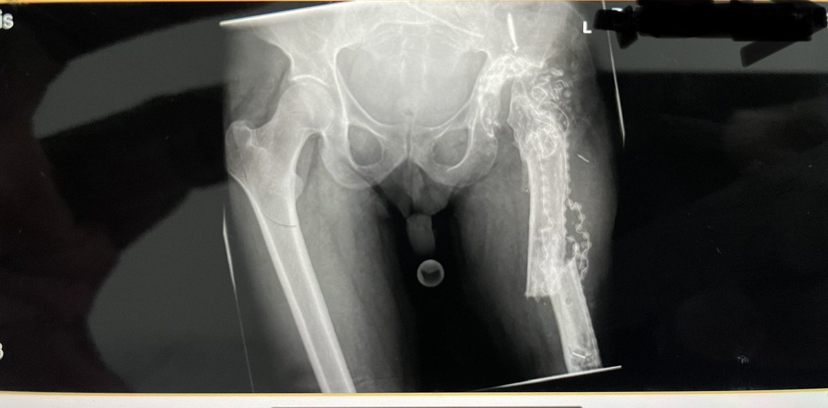 Felojunior's tweet photo. Somebody want to posted some "on call" nightmare.. I Start  with... 40 year, drug de. Fall from stand.... https://t.co/vztxobVeTy