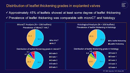 CMichaelGibson's tweet photo. HALT: In pts with self-expanding TAVs, no relationship btw duration of implant and thrombus / inflammation scores. Neointimal thickening, structural change, and calcification scores increased with time. #TCT2022 https://t.co/c5qGBBKR6R
