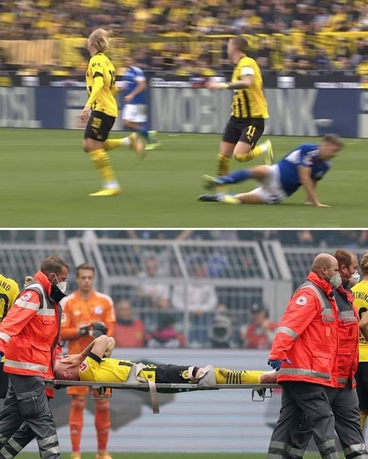 SportTap1's tweet image. 🚨 Gwo maledisyon!  Marco Reus soti ak dlo nan je sou yon branka kont Schalke
 ❌ Euro 2012: pa prezan pou blesi
 ❌ 2014 Koup did mond: pa prezan pou blesi
 ❌ Euro 2016: pa prezan pou blesi
 ❌ Euro 2021: pa prezan pou blesi
 ⏳ 2022 Koup di mond : blese e ensèten 2 mwa avan.