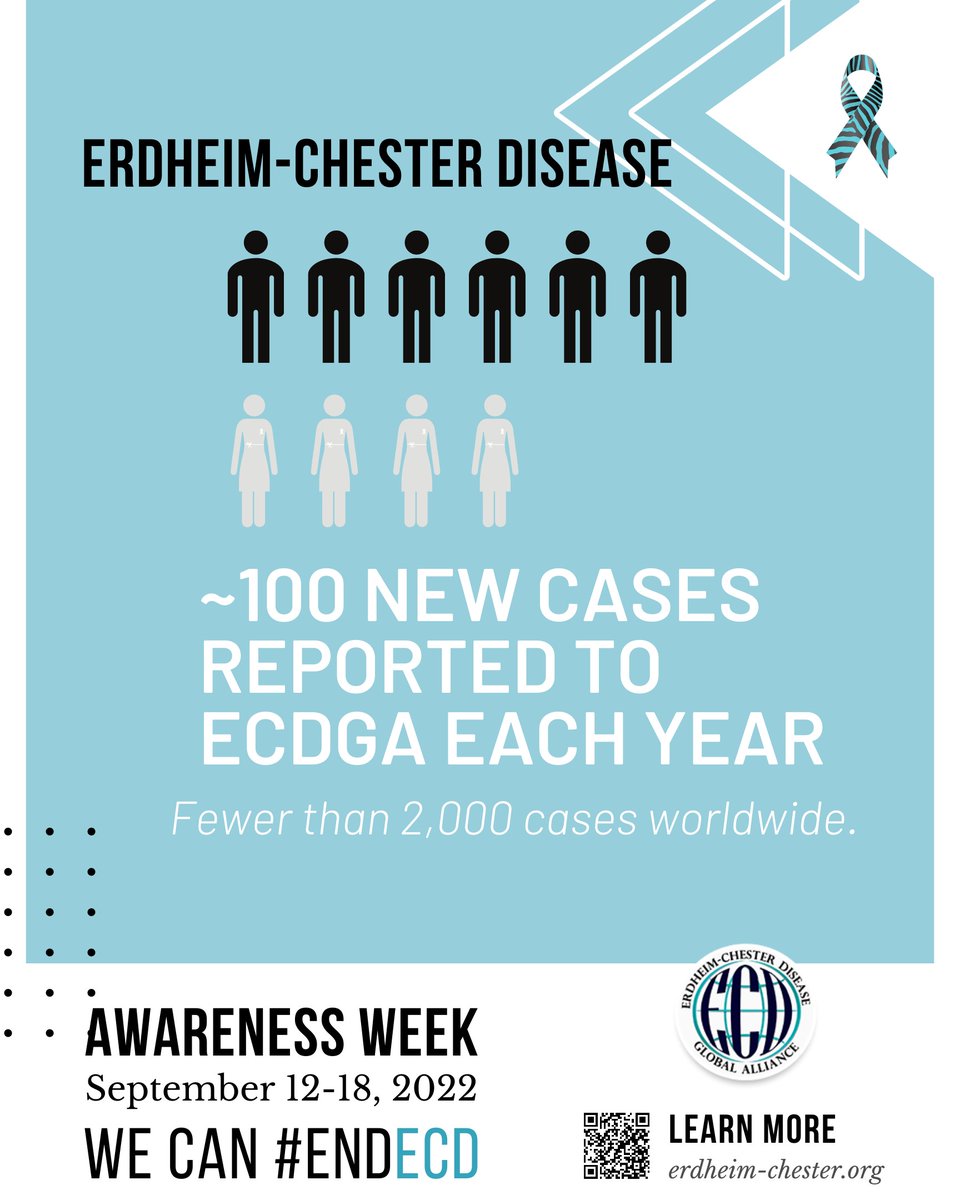 ECDGA's tweet photo. Because Erdheim-Chester Disease is so rare and difficult to diagnose, it may be underdiagnosed or misdiagnosed frequently. ECD most often occurs in adults during middle age; it is very rare in children. There are slightly more males than females diagnosed with ECD. #endECD https://t.co/NvJExAZYxr