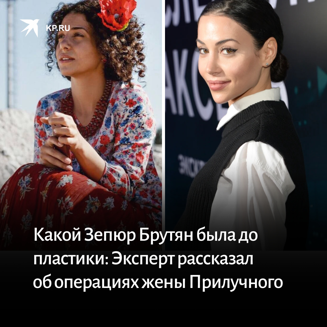 зепюр до пластики и после фото