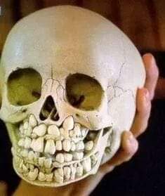 MsCiencia2's tweet photo. Cráneo de niño con dientes de leche y permanentes. https://t.co/PRwo1l6m2r