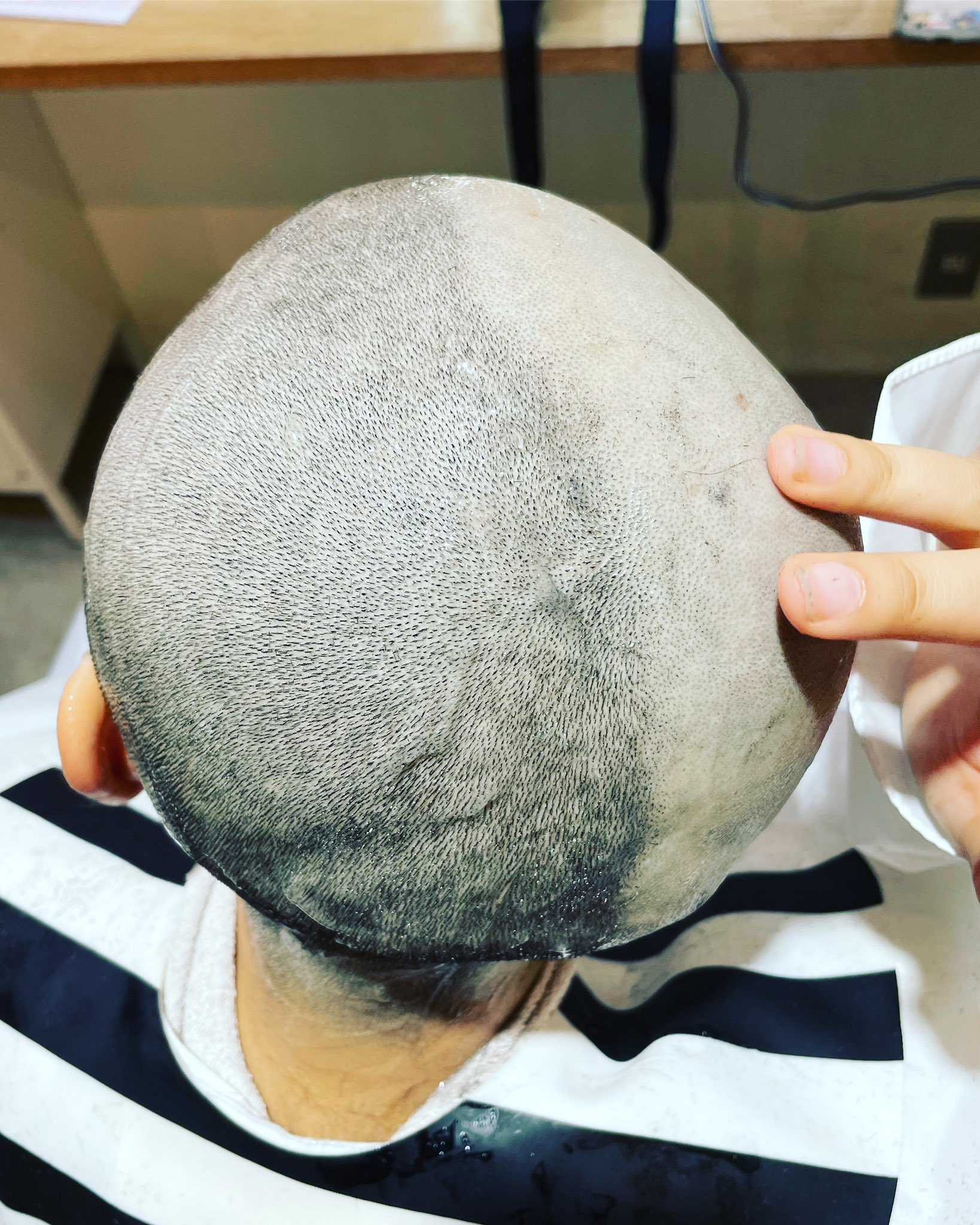 ばしし撮影カットモデル様募集中(都内)カット代無料 モデル代お支払い ヘアドネーション対応 on Twitter "半分スキンヘッドにした