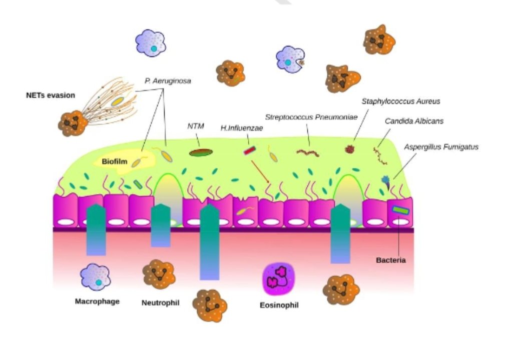 KessnerJp's tweet photo. Bronchiectasis: Pathophysiology of chronic bronchial infection.
https://t.co/GYqReFEi57
🫁😮‍💨🧫🧬🔬
@socapnet
@pneumobell
@NeumologiaHR @NeumoMadrid @EnfermeriaSepar @ArchBronconeumo 
@atscommunity @EuroRespSoc @ERSpublications 
@dgp @SPLF_SocPneumo @pneumosbpt https://t.co/D4OekAgXuM