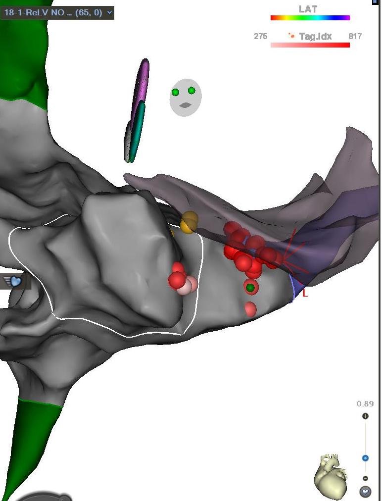 Edward Gerstenfeld tweet media