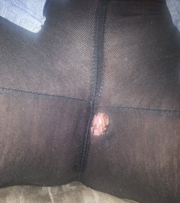 Don't you hate it when your comfy yoga pants form this hole... Naturally, you stretch it to make room<a href="/tag/smoking"class="tags"><span>#smoking</span></a><a href="/tag/happy420"class="tags"><span>#happy420</span></a><a href="/tag/smokingfetish"class="tags"><span>#smokingfetish</span></a><a href="/tag/sexysmoker"class="tags"><span>#sexysmoker</span></a>