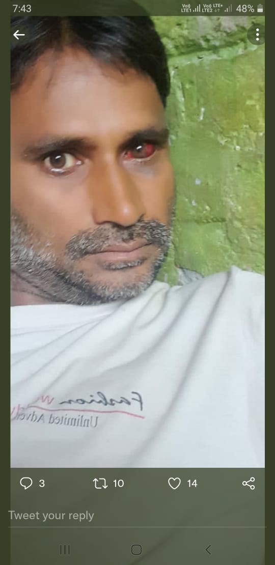 Santosh43293016's tweet photo. सीतापुर के थाना संदना के थानाध्यक्ष की अभिरक्षा में दिनांक १३/९/२०२२ को गोंदलाम ऊ चौकी इंचार्ज मानपाल सिंह ने थाने में आकर अम्बुजा अस्थाना की आंख पर मारा और फिर पटा चलाया,क्या अम्बुजा को पुलिस अपराधी बनाना चाहती है। @sitapurpolice @adgzonelucknow @Igrangelucknow https://t.co/oD1pC34Uir