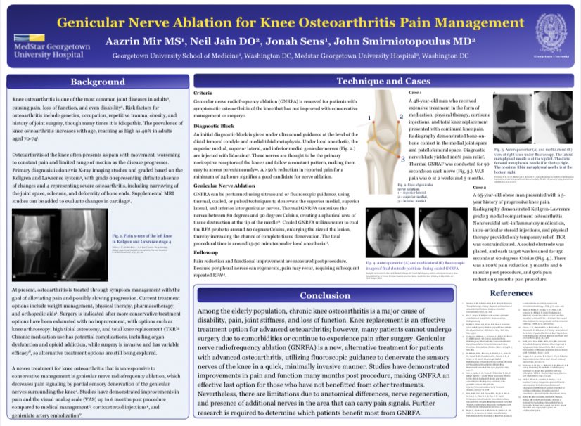 Neil K Jain (@digitalangio) on Twitter photo Amazing job <a href="/aazrinmir/">Aazrin Mir</a>! Innovative ways to treat #backpain and #osteoarthritis by #IRad
<a href="/AmericanPain/">AmerPainFoundation</a> <a href="/OrthoToday/">Orthopedics Today</a> <a href="/Ortho_Clinics/">Orthopedic Clinics</a> <a href="/SIRspecialists/">Society of Interventional Radiology</a> <a href="/SIRRFS/">SIR RFS</a> <a href="/GUMedicine/">Georgetown Medicine</a> <a href="/johnsmirnMD/">John Smirniotopoulos</a> <a href="/jonahnsens/">Jonah Sens</a> <a href="/Georgetown_IR/">Medstar Georgetown IR</a> Amazing job <a href="/aazrinmir/">Aazrin Mir</a>! Innovative ways to treat #backpain and #osteoarthritis by #IRad
<a href="/AmericanPain/">AmerPainFoundation</a> <a href="/OrthoToday/">Orthopedics Today</a> <a href="/Ortho_Clinics/">Orthopedic Clinics</a> <a href="/SIRspecialists/">Society of Interventional Radiology</a> <a href="/SIRRFS/">SIR RFS</a> <a href="/GUMedicine/">Georgetown Medicine</a> <a href="/johnsmirnMD/">John Smirniotopoulos</a> <a href="/jonahnsens/">Jonah Sens</a> <a href="/Georgetown_IR/">Medstar Georgetown IR</a>