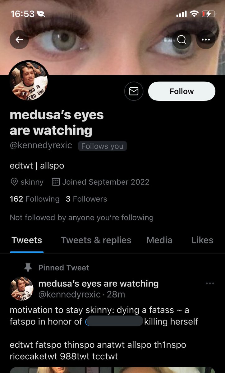 vanillekuesse's tweet photo. what the fuck just followed me can you all do me a favor and go report this disgusting ass...thing? https://t.co/Qj9gcK4PU6