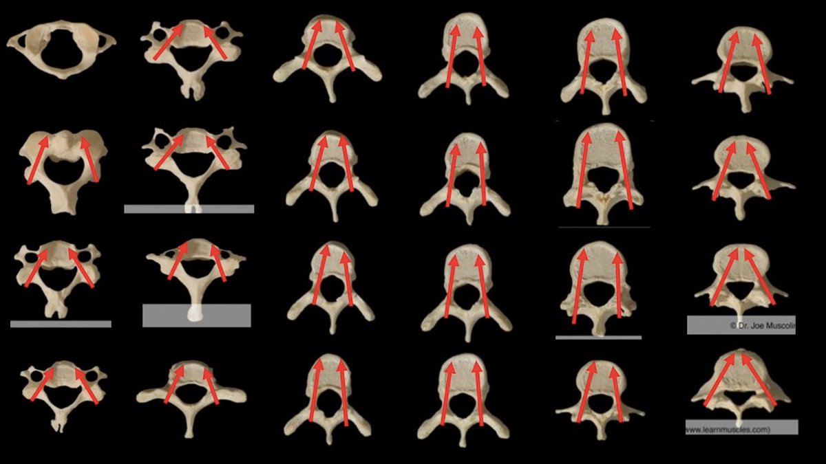 An interesting exercise to understand pedicle anatomy. Screw trajectories are generally predictable and intra-op safety (in the absence of navigation) is aided by obtaining true AP fluoroscopy. Images taken from learnmuscles.com