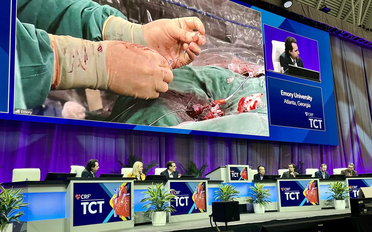 bobbyhassid's tweet photo. Live case Main Coronary Theater. Amazing discussion, amazing case! #fullrevascularization @ColumbiaMed @ColumbiaSurgery @nyphospital #CardioTweets https://t.co/pRu7afm2Fx