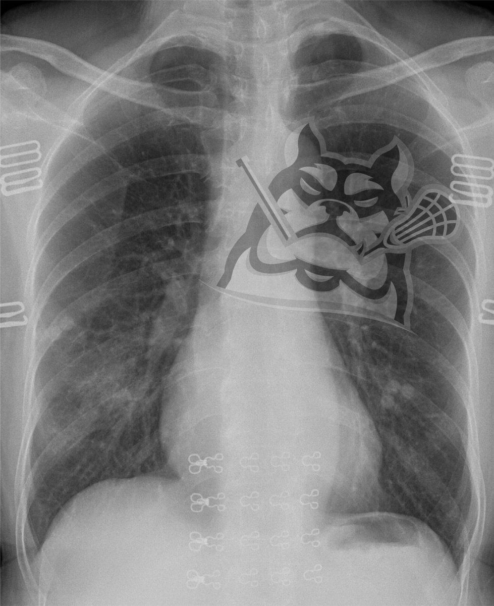 PGreggy's tweet image. Dillon Ward #PLLFinal