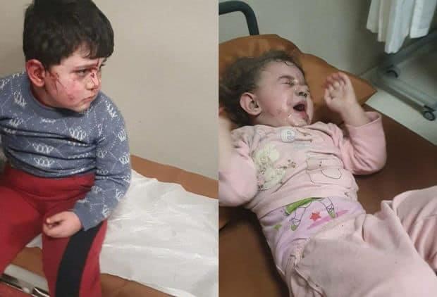 leylachx's tweet photo. #NoPelosi @SpeakerPelosi How would you feel if these were your children? These children and many more were injured due to the Armenian aggression which you lovely support. You promote terrorism and violence towards innocent kids and toddlers. You don't deserve to be a speaker. https://t.co/5Kng9RrxST