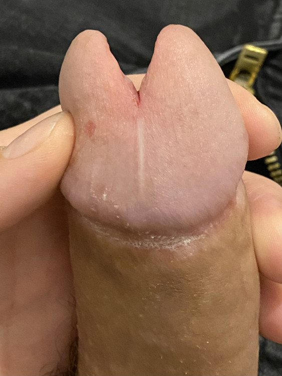 Mod13791's tweet photo. My moded cock
#subincision #splitglans #cockmods https://t.co/YKjyAItbwt