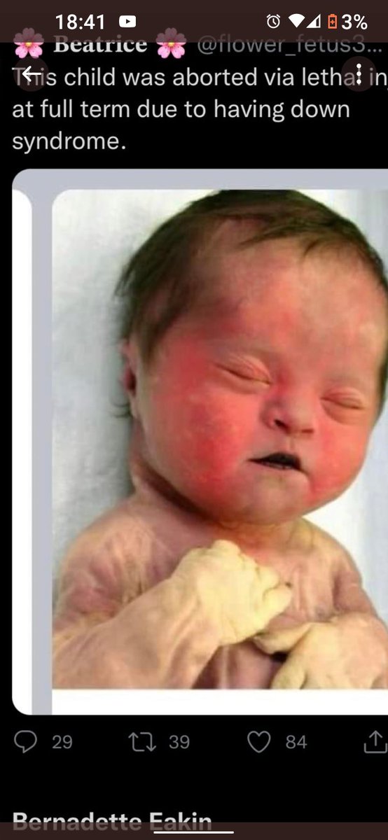 Bernadette Eakin tweet media