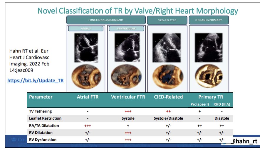 hahn_rt's tweet image. Speaking now at Philips Engagement Hub #TCT2022.  Hear about tricuspid valve imaging!!! @TCTMD