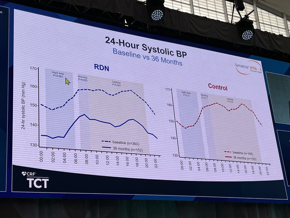 #SYMPLICITY HTN-3 trial shows significant ⬇️ in office & 24h ambulatory SBP to 3yrs w/ RDN compared w/ sham, independent of meds! Potential confounding factors may have played a role.. No late emerging complications.. #TCT2022 #LBCT @crfheart @TCTConference @DLBHATTMD #ACCIC