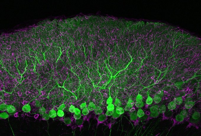 chrost_hugo's tweet photo. Purkinje cells in the cerebellum. Always amazing!
From @maxplanckpress
#neuroscience #neurotwitter #sciencetwitter #brain #Bioinformatics #neurology #science #medicine #MedTwitter #biotech https://t.co/cyTi2tQnsu
