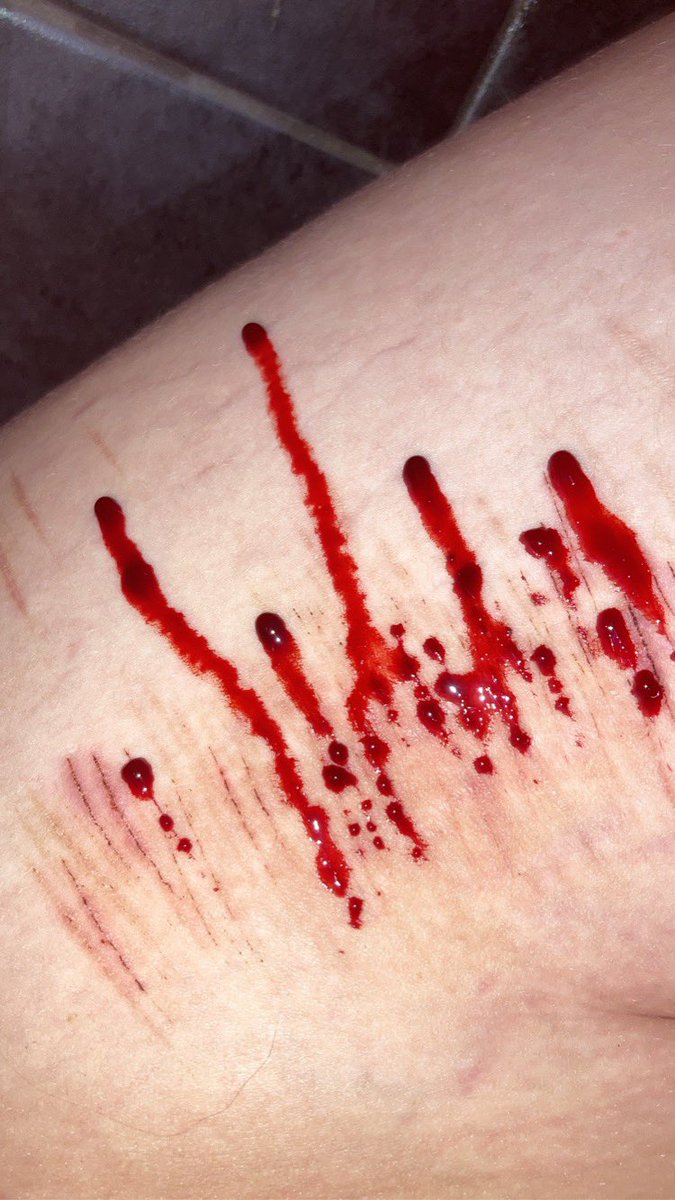 imhisbfbitch's tweet photo. aight twitter i know u waited for this moment GUESS WHOS BACK!!!

fake!! /j tw sh

shtwt bloodtwt catscratchtwt styrotwt raspberryfillingtwt https://t.co/Amd7qxpHwE