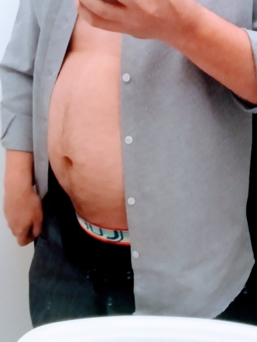 bulgingbladder's tweet photo. #malepregnancy #pregnantmale π€ no
#bloating #malebloating π€ noπ€
#hardtotype #maledesperation it's me #burstingtopiss https://t.co/OrHZIwjSNd