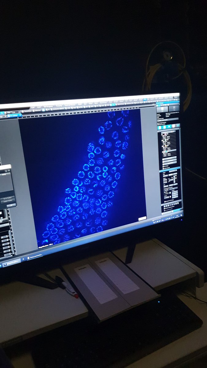 Hands on in the first practical to learn chromosome tagging in meiosis with dCas9 using C.elegans in S. Köhler's lab. #EMBOCellBiology