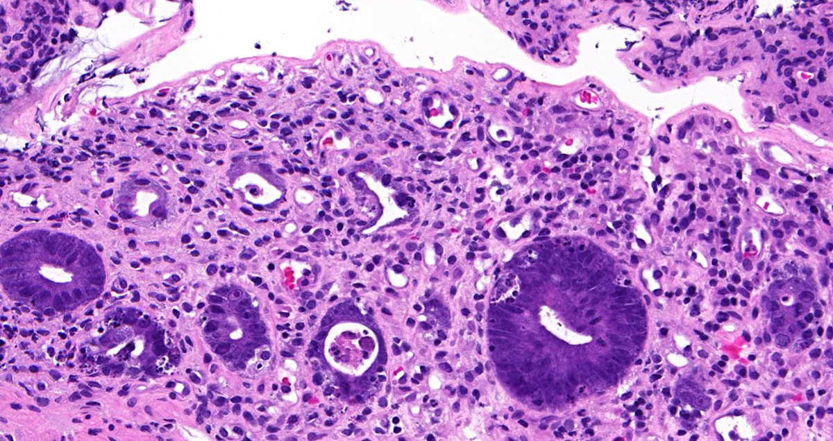 Tristan Rutland MBBS FRCPA IFCAP tweet media