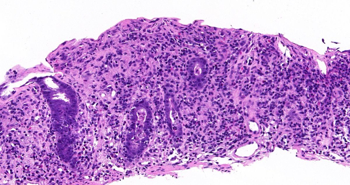 Tristan Rutland MBBS FRCPA IFCAP tweet media