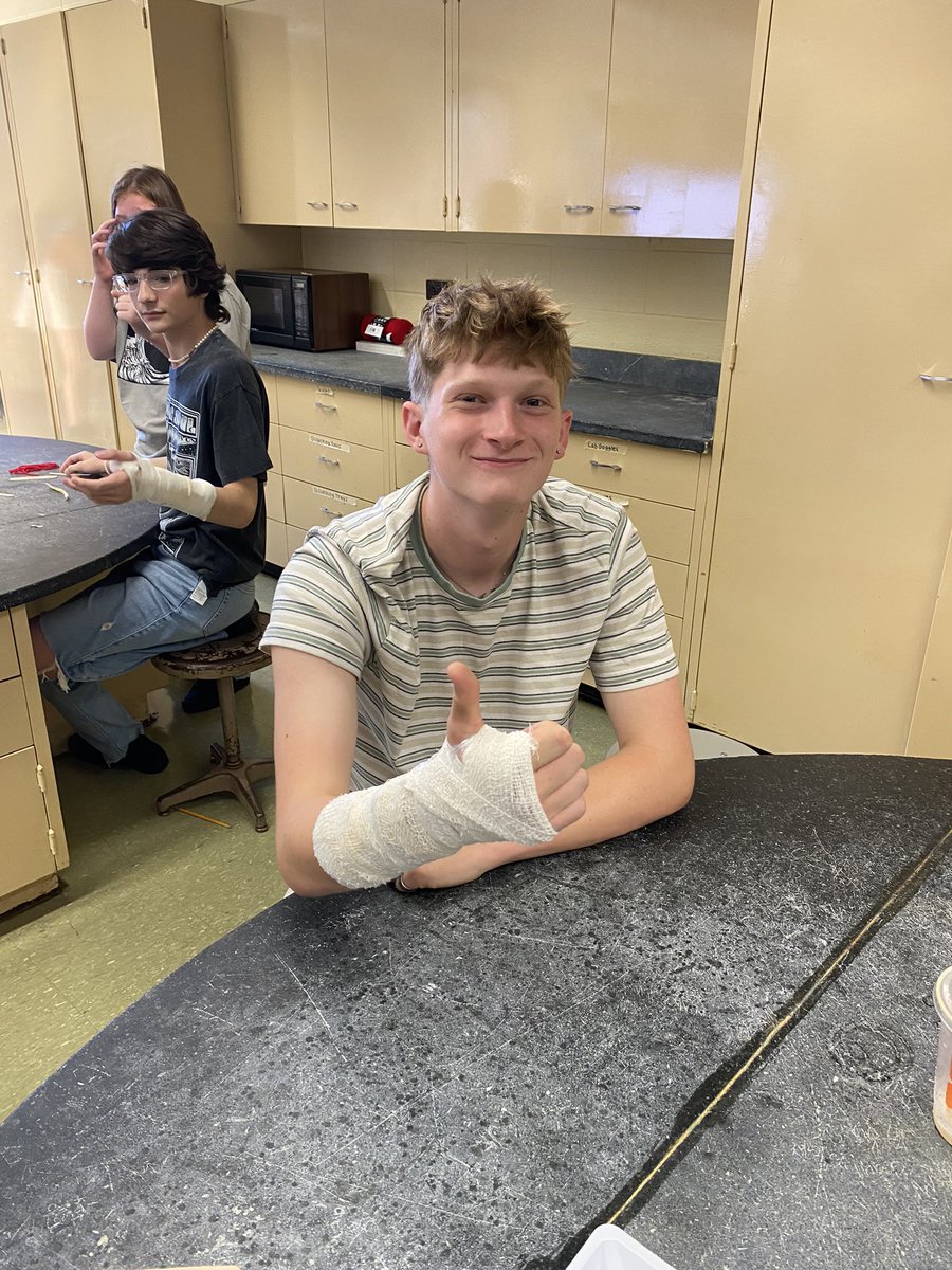 Students used their creativity to design makeshift casts in biomed 🦴
