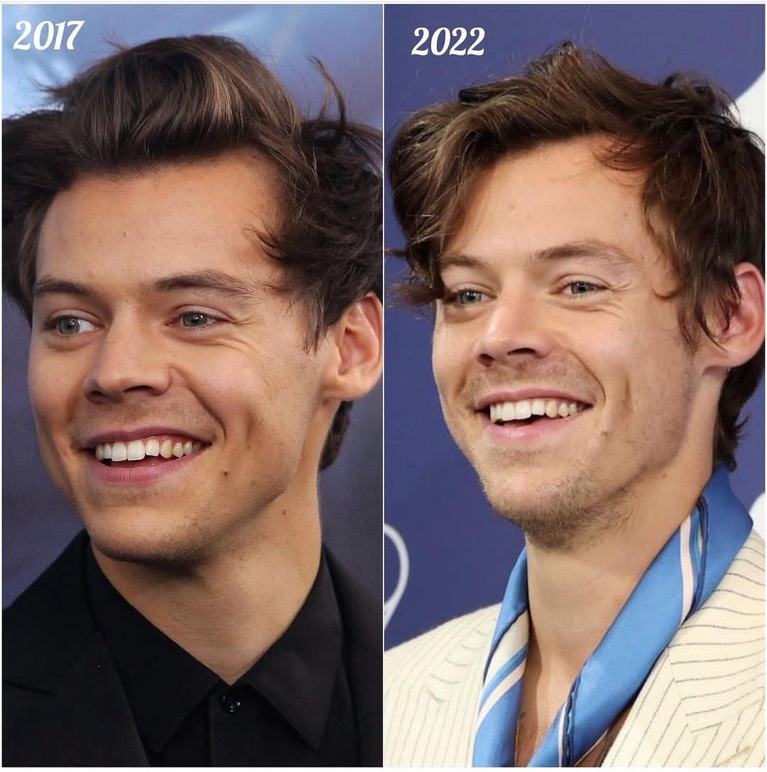 The night changes, but Harry's smiles don't:>>>>