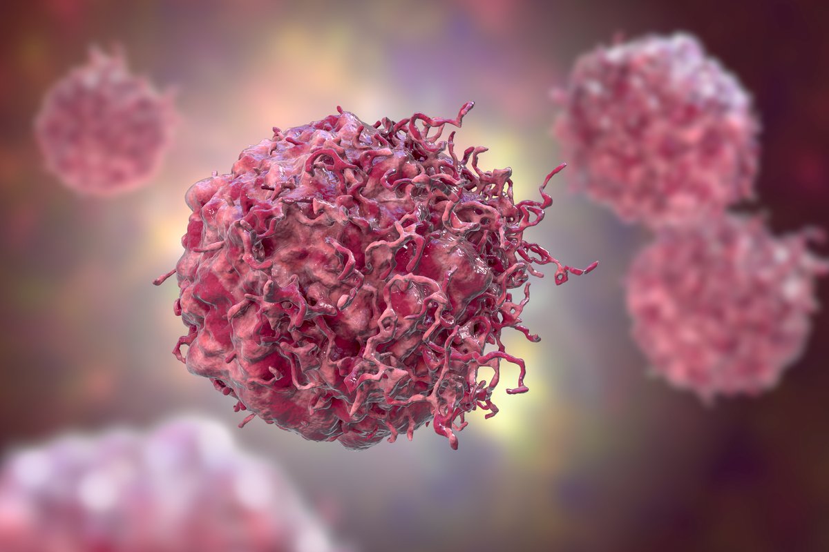 ATCC_LGC's tweet photo. #MerkelCellCarcinoma (MCC) is a rare #Cancer that is hard to research due to a lack of appropriate tissue models. However, a recent study has shown that #Organoids could be the answer to this tricky problem💪

Find out how in @Nature: https://t.co/fPY0SJbNis

#OrganoidPower https://t.co/zLvfr8Wt2Z
