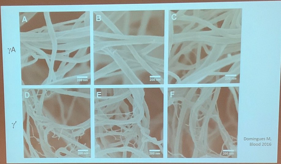 caterina casari (@caterinacasari) on Twitter photo Great science, beautiful images, new assays! One more very interesting session at #ISFP2022 <a href="/ISFP_PA_2021/">ISFP & PA 2022</a> with a fantastic SoA by <a href="/RobertAriens/">Robert Ariens</a> followed by oral presentations by Dr Claesen and <a href="/SimpsonMegan8/">Megan Simpson</a> Great science, beautiful images, new assays! One more very interesting session at #ISFP2022 <a href="/ISFP_PA_2021/">ISFP & PA 2022</a> with a fantastic SoA by <a href="/RobertAriens/">Robert Ariens</a> followed by oral presentations by Dr Claesen and <a href="/SimpsonMegan8/">Megan Simpson</a>