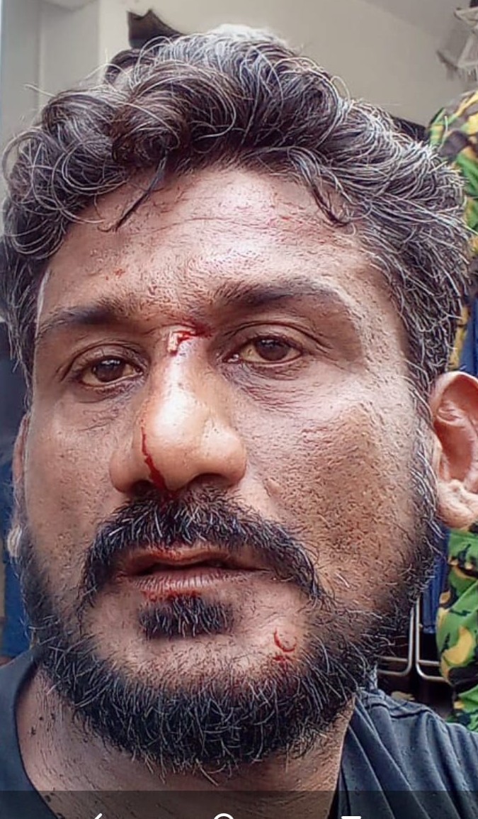 JDSLanka's tweet image. Oshantha Prasad Dābare of #Wellawatta, who was actively involved in the recent protest campaign &amp;amp; brutally assaulted by a govt. orchestrated mob on May 9,  was summoned to the Criminal Investigation Dept. in #Colombo, today, to obtain a statement.