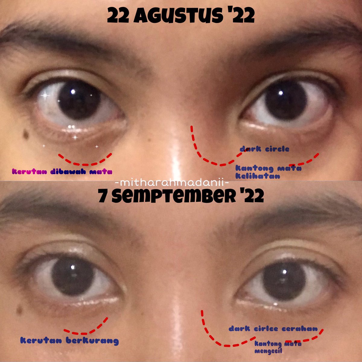 Mitha Nurrizki Rahmadani On Twitter 12 Eye Cream Eye Cream Under 50k mitha-nurrizki-rahmadani-on-twitter-12-eye-cream-eye-cream-under-50k