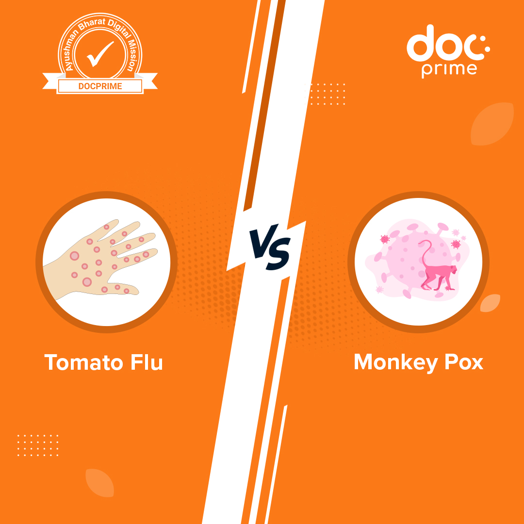 docprimeIndia's tweet photo. After Corona, we now have two more viruses making headlines. Cases of Monkey Pox and Tomato Flu have surfaced in India. 
It is to understand that early detection is the key in case of both of these viruses.
#monkeypox #tomatoflu #healthforall  #Docprime https://t.co/uNWRcwaoRM