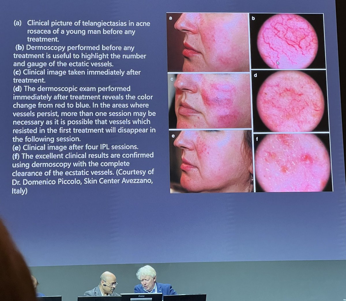 DrJoannaGold's tweet photo. #ESCAD plans to focus on the use of #dermoscopy in #esthetic and #cosmeticderm @eadv https://t.co/4YXPqt2C7K
