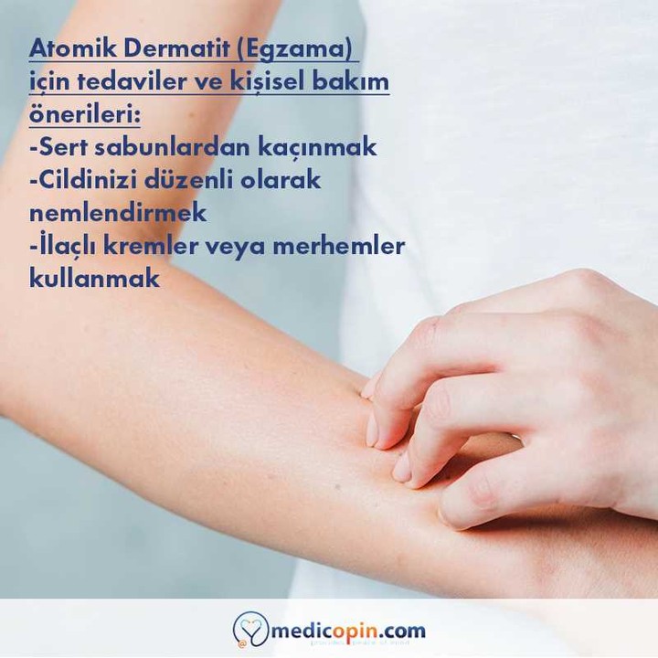 Egzama tedavisi için ipuçları