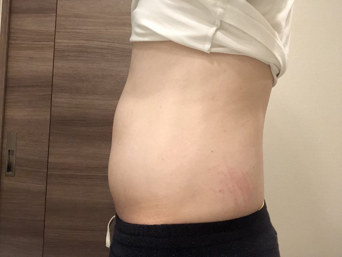 InfoTaishibou's tweet photo. 2022.09.05〜ダイエット開始した。
身長175cm
体重81.95kg
痩せるか、絶対痩せるか。
体脂肪を穿て! https://t.co/FYE4SNo6Uj